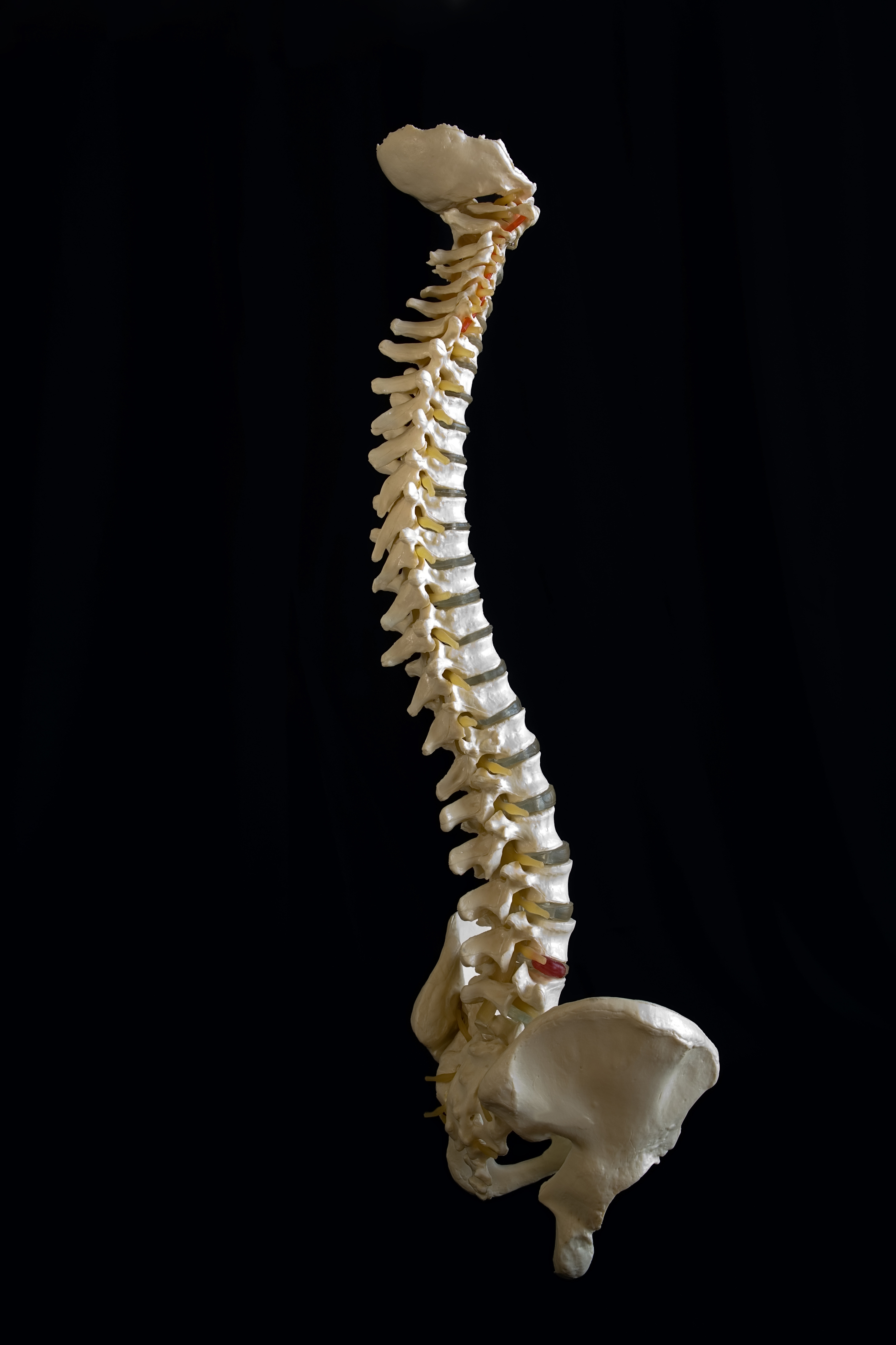 Spinal Cord Picture