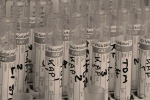 Injury at Work: Workers Comp after Failed Drug Test in Providence