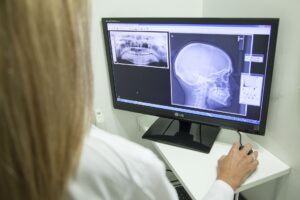 How Can You Prove Your Whiplash Claim?