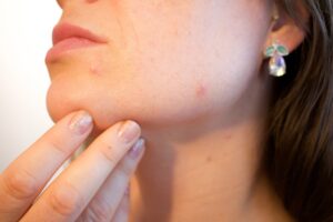 Plymouth Scarring Claims Lawyer: Factors Affecting Compensation